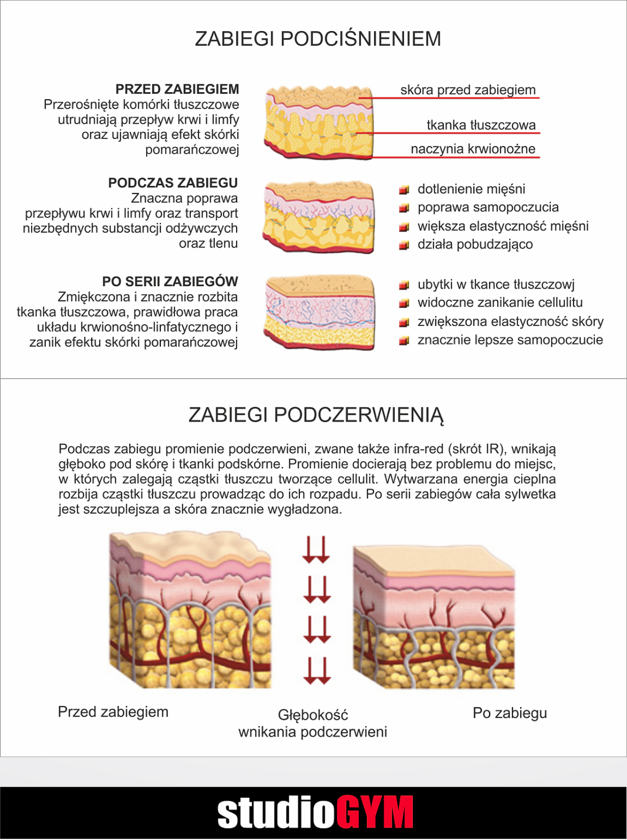 StudioGYM Vacu Activ Bieżnia | Szczecin Police | Fit Studio Figura Smukła Sylwetka | Fitness klub Vacu Bieżnia Podciśnienie Podczerwień | Siłownia Solarium Sauna Odchudzanie Opalanie Spa Welles